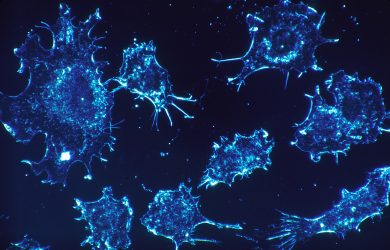 Why cancer needs to be reframed, not renamed